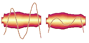 Before and after editing vibrato